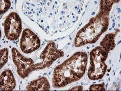 Immunohistochemistry: AK3L1 Antibody (OTI3B1) - Azide and BSA Free [NBP2-70129]