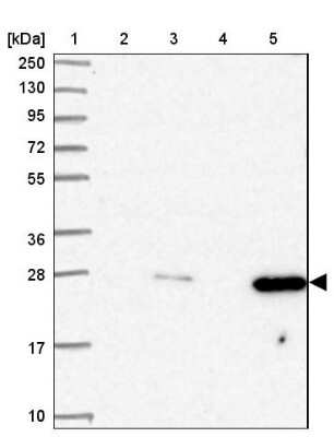 Western Blot: AK3L1 Antibody [NBP2-47553]