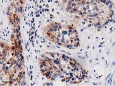 Immunohistochemistry-Paraffin: AK5 Antibody (OTI2F9) [NBP2-02978]