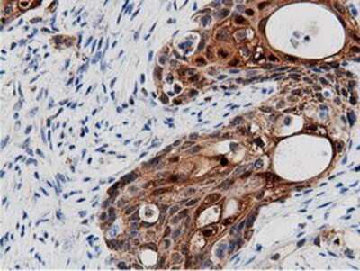 Immunohistochemistry-Paraffin: AK5 Antibody (OTI2F9) [NBP2-02978]