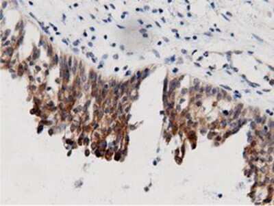 Immunohistochemistry-Paraffin: AK5 Antibody (OTI2F9) [NBP2-02978]