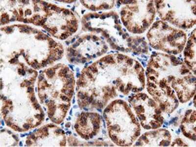 Immunohistochemistry-Paraffin: AK5 Antibody (OTI2F9) [NBP2-02978]