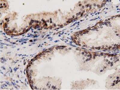 Immunohistochemistry-Paraffin: AK5 Antibody (OTI2F9) [NBP2-02978]