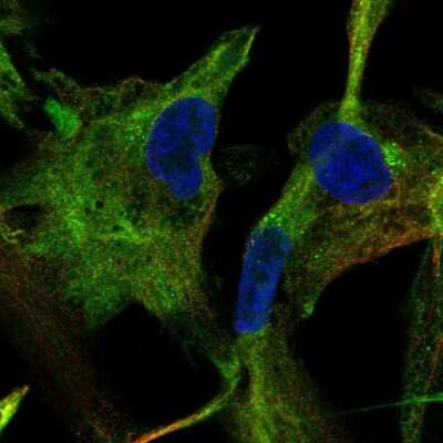 Immunocytochemistry/ Immunofluorescence: AK5 Antibody [NBP1-89453]
