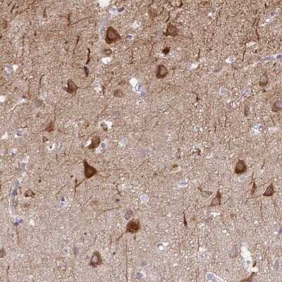 Immunohistochemistry-Paraffin: AK5 Antibody [NBP2-33821]
