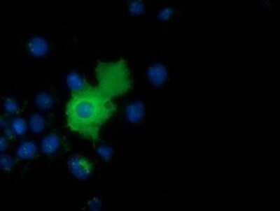 Immunocytochemistry/ Immunofluorescence: AK5 Antibody (OTI2F9) - Azide and BSA Free [NBP2-71813]
