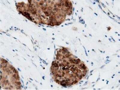 Immunohistochemistry: AK5 Antibody (OTI2F9) - Azide and BSA Free [NBP2-71813]