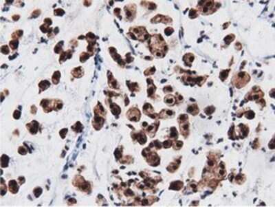 Immunohistochemistry: AK5 Antibody (OTI2F9) - Azide and BSA Free [NBP2-71813]