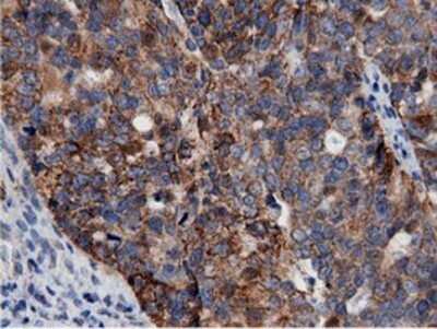 Immunohistochemistry: AK5 Antibody (OTI2F9) - Azide and BSA Free [NBP2-71813]