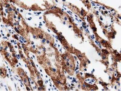 Immunohistochemistry: AK5 Antibody (OTI2F9) - Azide and BSA Free [NBP2-71813]