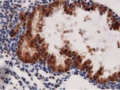 Immunohistochemistry: AK5 Antibody (OTI2F9) - Azide and BSA Free [NBP2-71813]