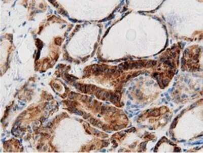 Immunohistochemistry: AK5 Antibody (OTI2F9) - Azide and BSA Free [NBP2-71813]
