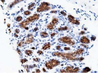 Immunohistochemistry: AK5 Antibody (OTI2F9) - Azide and BSA Free [NBP2-71813]