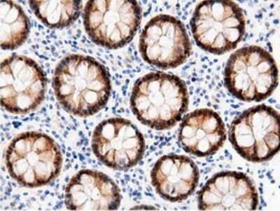 Immunohistochemistry: AK5 Antibody (OTI2F9) - Azide and BSA Free [NBP2-71813]