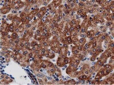 Immunohistochemistry: AK5 Antibody (OTI2F9) - Azide and BSA Free [NBP2-71813]