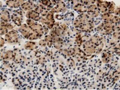 Immunohistochemistry: AK5 Antibody (OTI2F9) - Azide and BSA Free [NBP2-71813]