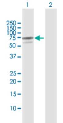 Western Blot: AK5 Antibody [H00026289-D01P]