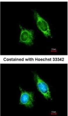 Immunocytochemistry/ Immunofluorescence: AKAP1 Antibody [NBP2-15319]