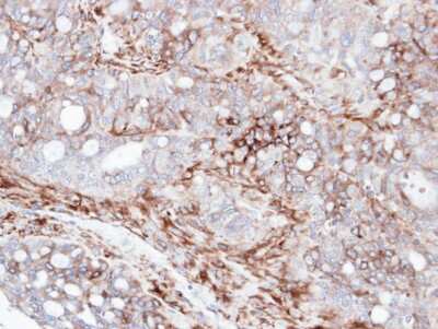 Immunohistochemistry-Paraffin: AKAP12 Antibody [NBP1-31482]