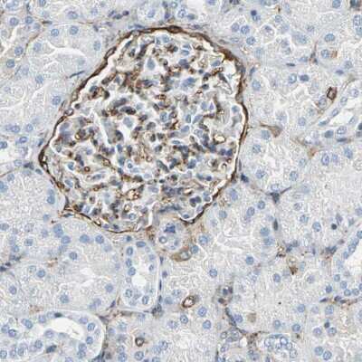 Immunohistochemistry-Paraffin: AKAP12 Antibody [NBP1-89168]