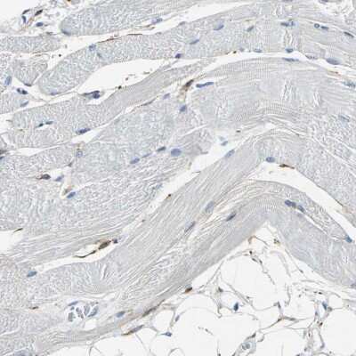 Immunohistochemistry-Paraffin: AKAP12 Antibody [NBP1-89168]