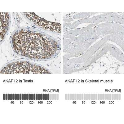Immunohistochemistry-Paraffin: AKAP12 Antibody [NBP1-89168]