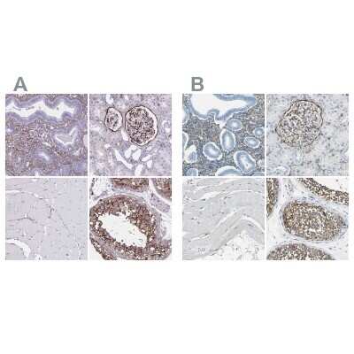 Immunohistochemistry-Paraffin: AKAP12 Antibody [NBP2-38786]