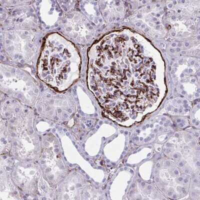 Immunohistochemistry-Paraffin: AKAP12 Antibody [NBP2-38786]