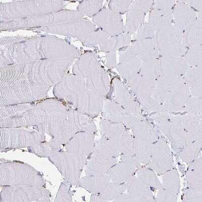 Immunohistochemistry-Paraffin: AKAP12 Antibody [NBP2-38786]