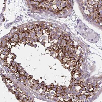 Immunohistochemistry-Paraffin: AKAP12 Antibody [NBP2-38786]