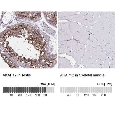 Immunohistochemistry-Paraffin: AKAP12 Antibody [NBP2-38786]