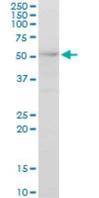 Western Blot: AKAP13 Antibody (3D6) [H00011214-M10]