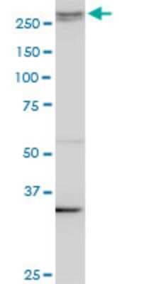 Western Blot: AKAP13 Antibody (3D6) [H00011214-M10]