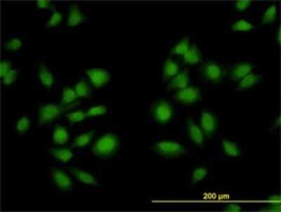 Immunocytochemistry/ Immunofluorescence: AKAP13 Antibody (5B7) [H00011214-M01]