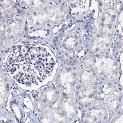 Immunohistochemistry-Paraffin: AKAP3 Antibody [NBP1-89173]