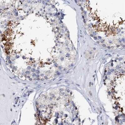 Immunohistochemistry-Paraffin: AKAP3 Antibody [NBP1-89173]