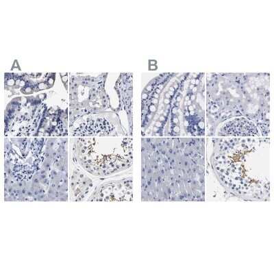 Immunohistochemistry-Paraffin: AKAP4 Antibody [NBP1-89164]