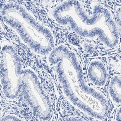 Immunohistochemistry-Paraffin: AKAP4 Antibody [NBP1-89165]