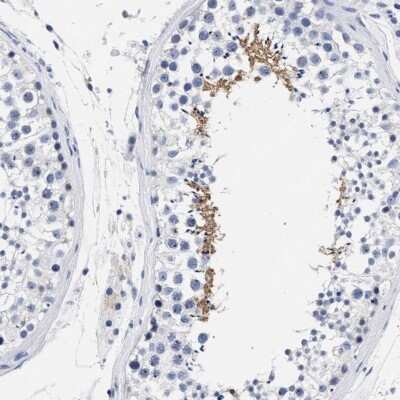 Immunohistochemistry-Paraffin: AKAP4 Antibody [NBP1-89165]