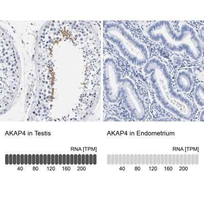 Immunohistochemistry-Paraffin: AKAP4 Antibody [NBP1-89165]