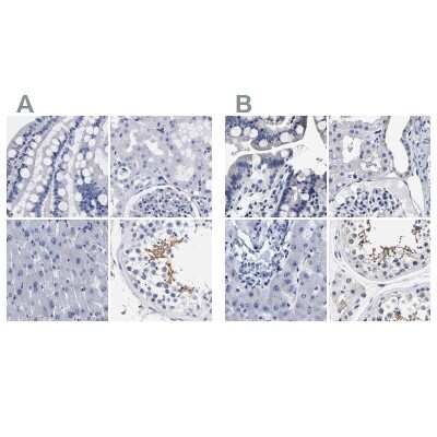 Immunohistochemistry-Paraffin: AKAP4 Antibody [NBP1-89165]