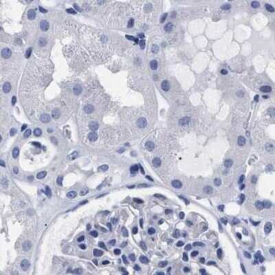 Immunohistochemistry-Paraffin: AKAP4 Antibody [NBP1-89165]