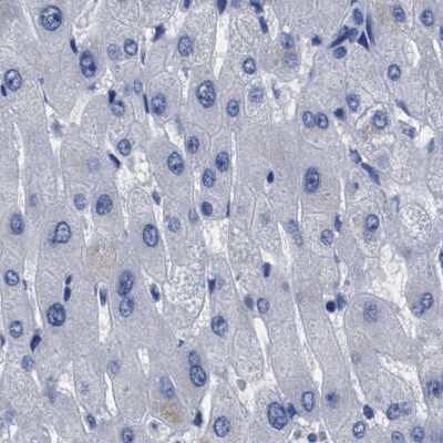 Immunohistochemistry-Paraffin: AKAP4 Antibody [NBP1-89165]