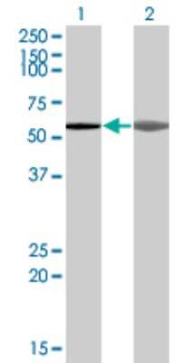 Western Blot: AKAP5 Antibody (1A9) [H00009495-M04]