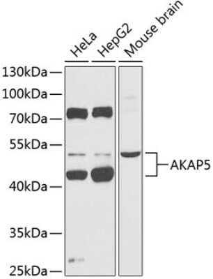 Western Blot: AKAP5 AntibodyBSA Free [NBP2-92620]