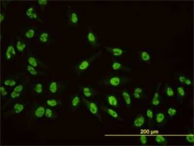 Immunocytochemistry/ Immunofluorescence: AKAP95/AKAP8 Antibody (3D4) [H00010270-M01]