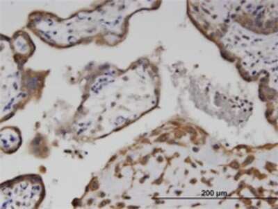 Immunohistochemistry-Paraffin: AKD1 Antibody (1H8) [H00221264-M01]