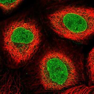 Immunocytochemistry/ Immunofluorescence: AKD1 Antibody [NBP2-33936]