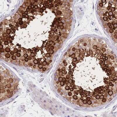 Immunohistochemistry: AKD1 Antibody [NBP2-34033]