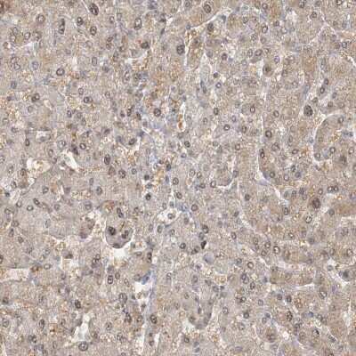 Immunohistochemistry-Paraffin: AKD1 Antibody [NBP2-33936]